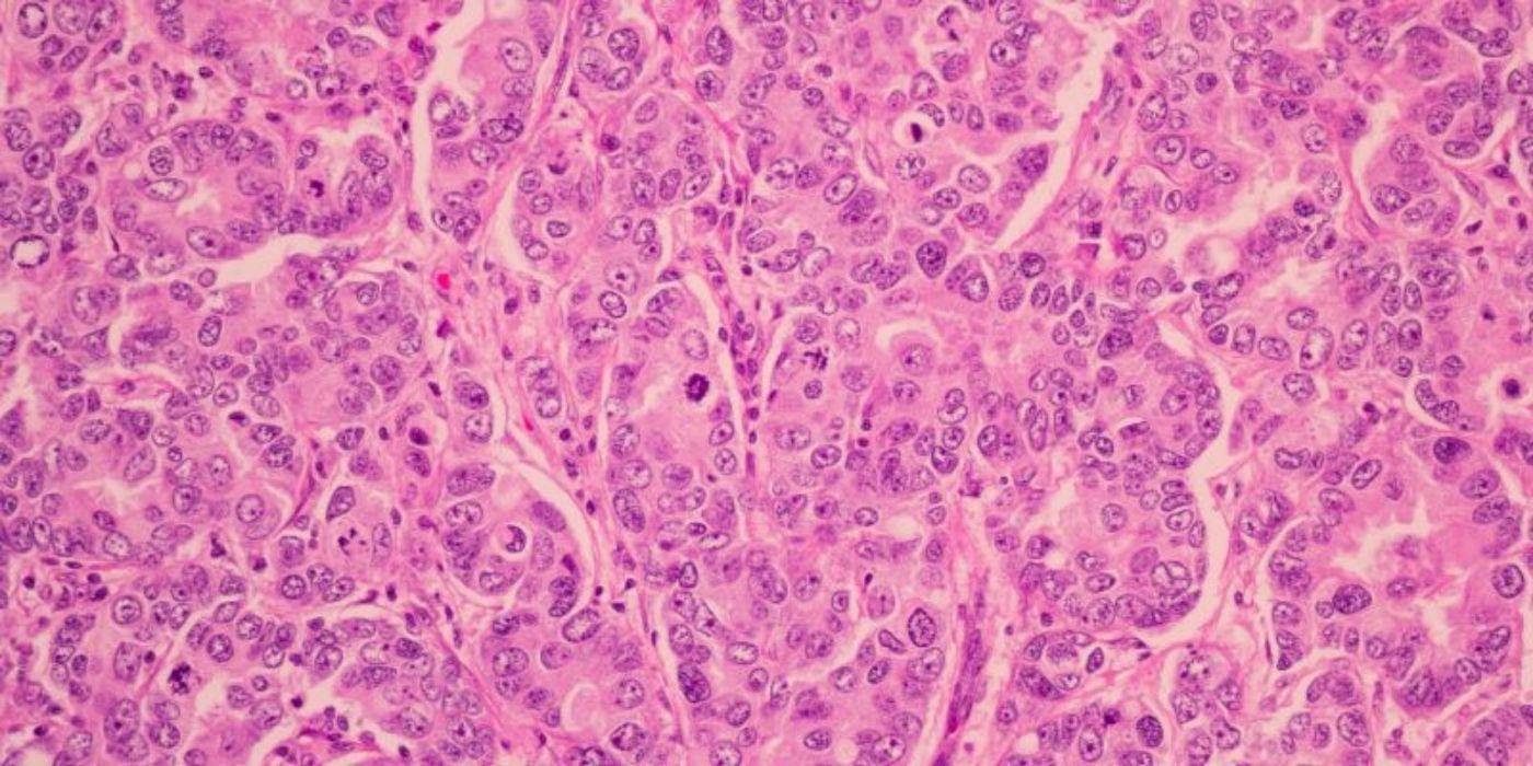 Cancer cells