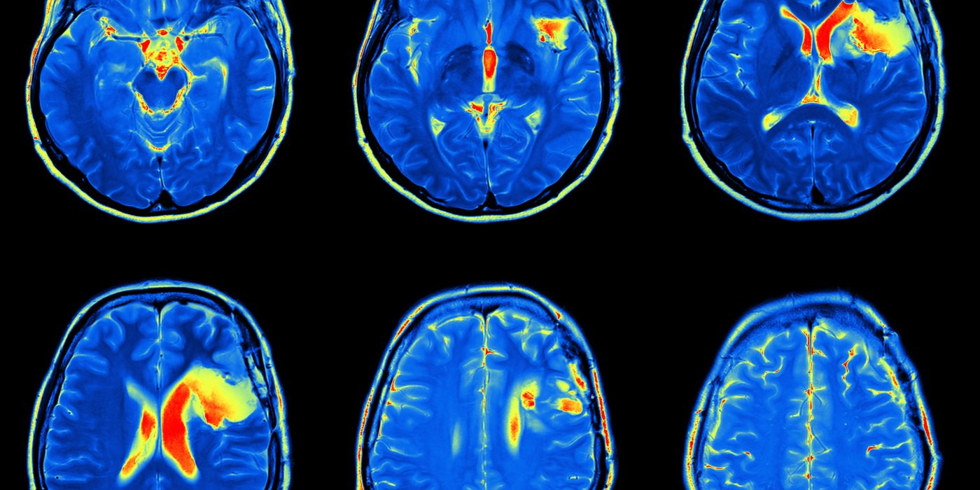 Cognitive neuroimaging