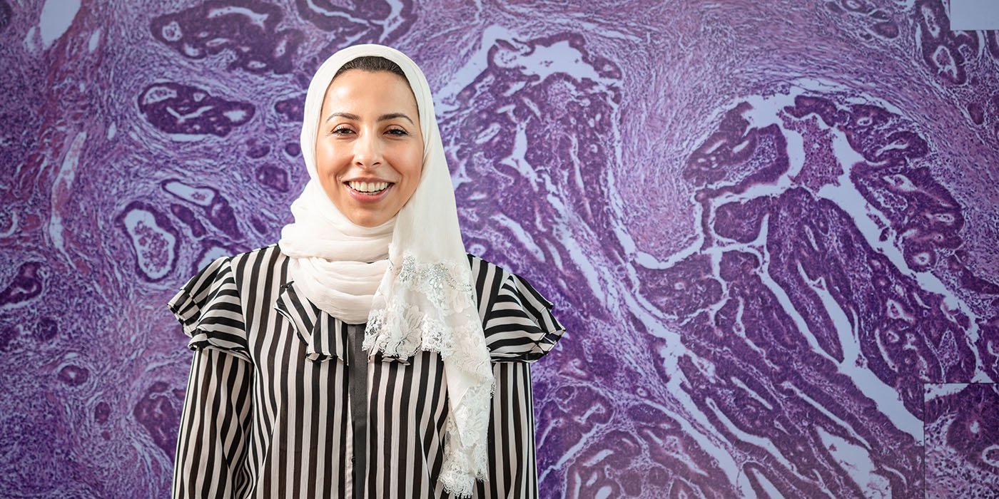 International student in front of cancerous bowel