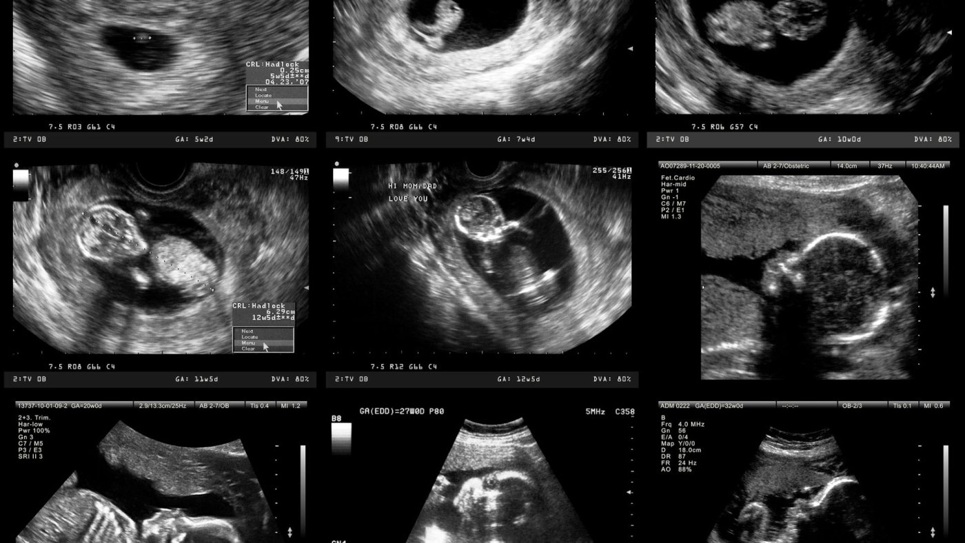 Sonography, Medical Ultrasound