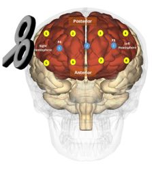 New smaller brain pic 2
