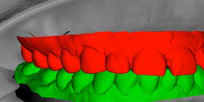 Digital dentistry master class
