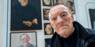 Participant Robin stands in front of a wall of portraits of him. He wears a realistic facial prosthesis that covers his eye and nose.