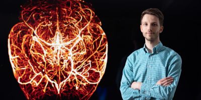british heart foundation image competition short listed finalists from the university of leeds were mike Drozd and Fraser Macrae from the leeds institute of cardiovascular and metabolic medicine