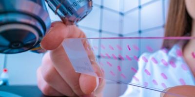 A close up of a plate with three lines of pink dots, samples, being held next to a microscope.
