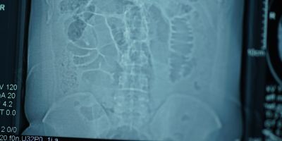 Sonogram internal organs or xray licamM