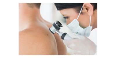 Reduction in immunotherapy treatment for skin cancer shows promise in clinical trial