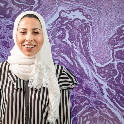 International student in front of cancerous bowel
