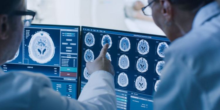 Two male doctors looking at a computer screen showing brain scans