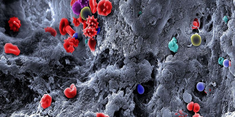 BHF research photo