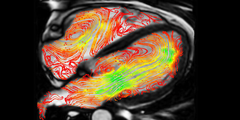 BHF research image Blood flow 1200x600