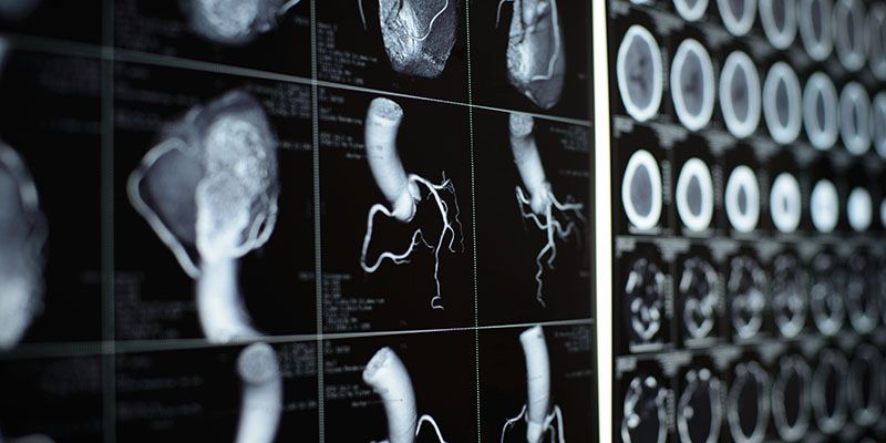 Human heart and coronary artery images representing our research